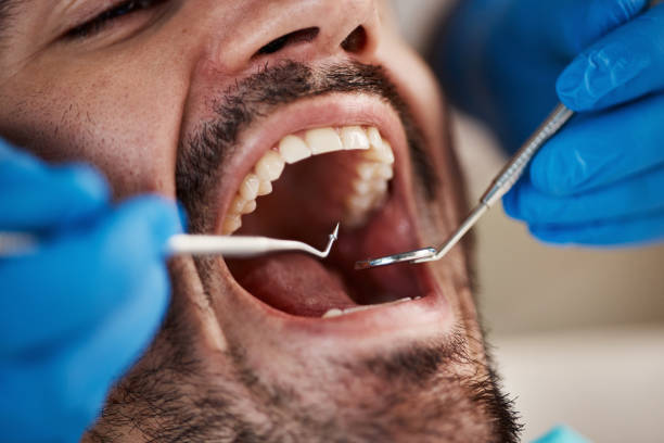 Best Pediatric Emergency Dentist in Savage, MD