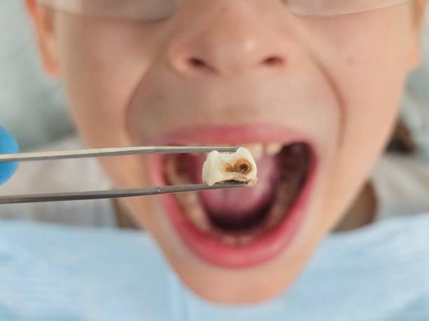 Best Urgent Dental Care for Toothache in Savage, MD